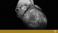     Título: Corazón Crudo Autor: Sandra R. Fernández y José Luis Ordóñez Editorial: El Sendero Páginas: 204 ISBN: 978-84-941351-1-8 Precio: 15€ Puedes comprarlo aquí     «CORAZÓN» es un […]